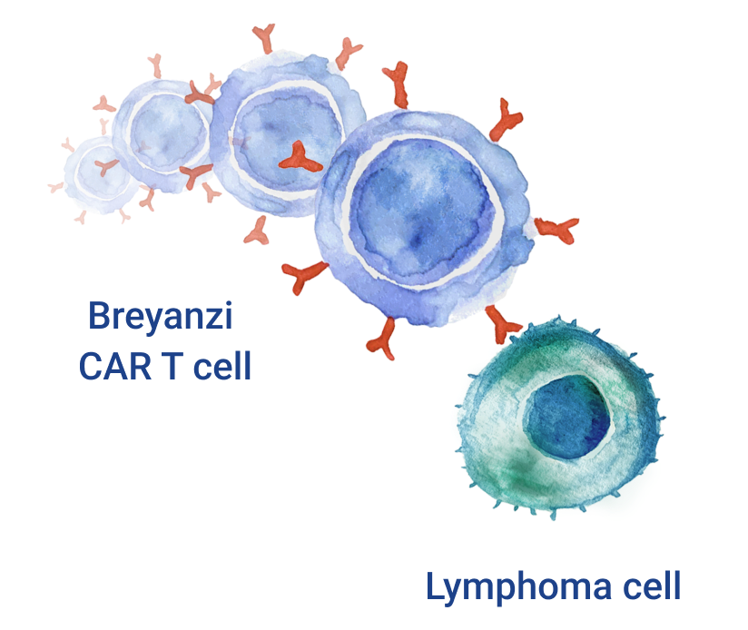 Breyanzi® (lisocabtagene maraleucel) CAR T cell and lymphoma cell